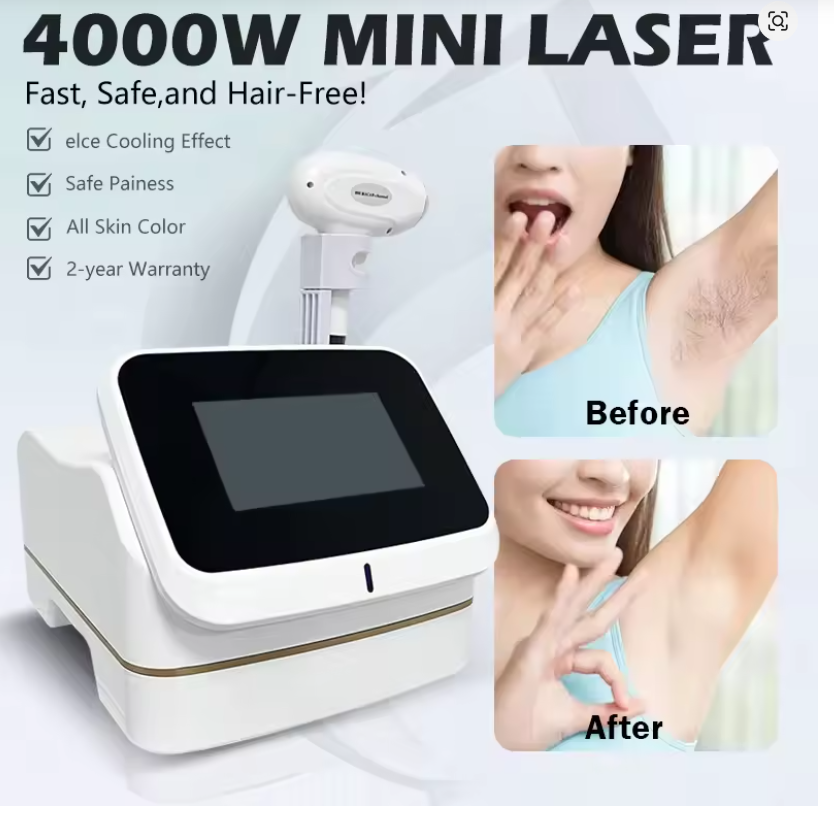 Industrial Laser Hair Removal Machine - 3 Wavelength 5000W 808nm Lase Diode
