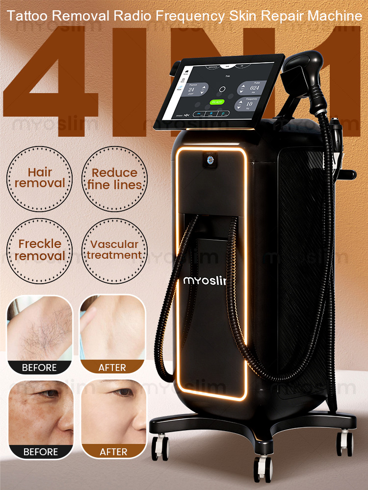 4 IN 1 Soprano Titanium Ice Pl - Industrial Laser Hair Removal Machine recension och pris